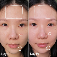 Tinh Chất Tái Tạo Da Kiehl’s Retinol Skin Renewing Daily Micro-Dose