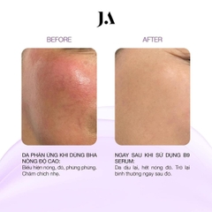 Serum B9 Juliette Armand Folic Acid 20ml giảm kích ứng phục hồi da - 20ml Fullbox - Hàng công ty
