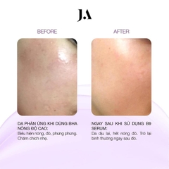 Serum B9 Juliette Armand Folic Acid 20ml giảm kích ứng phục hồi da - 20ml Fullbox - Hàng công ty