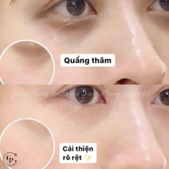 Combo 2 Kem mắt SKII Skinpower Eye Cream mini nobox 2.5g x 2 - Hàng công ty