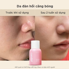 Tinh chất Retinol Candid 30ml - Fullbox Hàng Công Ty