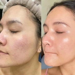 Kem Ahohwa Vitamin K Cream 12g Phục Hồi Giảm Thâm Đỏ Da - Nobox - Hàng Công Ty
