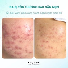 Kem Ahohwa Vitamin K Cream 12g Phục Hồi Giảm Thâm Đỏ Da - Nobox - Hàng Công Ty