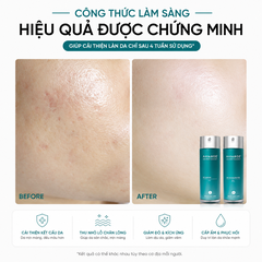 Bộ đôi Ante Age - Set Pro System (Serum 30ml+Accel erator 30ml)