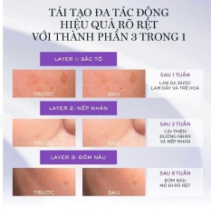 Tinh Chất Lancome Rénergie C.R.x. Triple Serum Retinol 50ml Fullbox - Hàng US