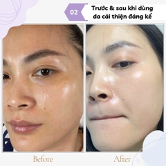Huyết tương Evenwiss Regenerating Plasma