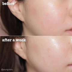 Toner Estee Lauder Dành Cho Da Khô, Thường, Nhạy Cảm Soft Clean Infusion Hydrating Essence Lotion (Bản Mỹ)