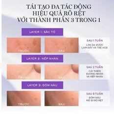 Serum Retinol Tươi 3 Lõi Lancome Renergie C.R.x Triple Retinol 3ml - Hàng Công Ty