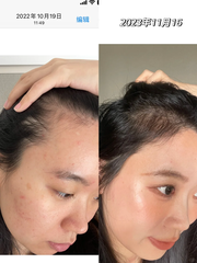 Xịt Mọc Tóc Minoxidil Bailleul Pháp - 60ml