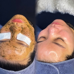 Mặt Nạ Thảo Dược Peel Christina BioPhyto 4A Herbal Peel Thải Độc Sáng Da