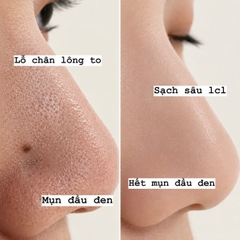 Tẩy da chết dạng gel Dr.G Brightening Peeling Gel 120g Tách set Nobox