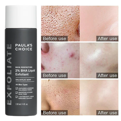 Tẩy Tế Bào Chết Hóa Học Paula’s Choice Skin Perfecting 2% BHA Liquid