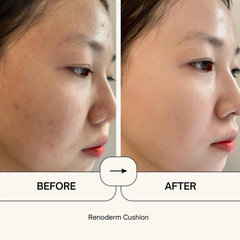 Cushion Renoderm Day long BB Cream Silver 15g - Hàng Công Ty