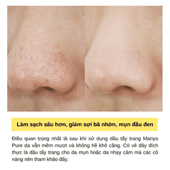 Dầu Tẩy Trang Manyo Pure Cleansing Oil