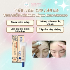 Serum Giảm Mụn Meishoku Bigan Xẹp Mụn Giảm Sưng Viêm Mờ Thâm Nhật Bản Acne Essence Túyp 15g - TẶNG 1 SRM GIẢM MỤN MEISHOKU 15G