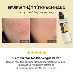 Tinh Chất Ốc Sên Cosrx Advanced Snail 96 Mucin Essence Cấp Ẩm Làm Dịu Phục Hồi Chống Lão Hóa Hàn Quốc 100ml