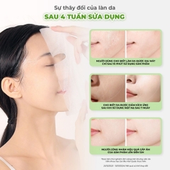 Mặt Nạ BNBG Vita Genic Jelly Mask Cấp Ẩm Phục Hồi Căng Bóng Da Hàn Quốc Hộp 10 Miếng