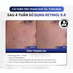 Kem Dưỡng MD CARE PRO-RETINOL 0.6 Trẻ Hóa Sáng Da Cải Thiện Nếp Nhăn 30ml