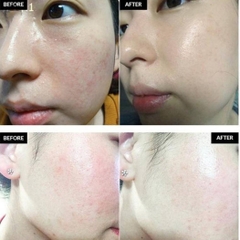 Serum Mediphar+ Hydrating B5 Cấp Ẩm Phục Hồi Dưỡng Sáng Da Hàn Quốc 30ml