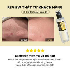 Tinh Chất Ốc Sên Cosrx Advanced Snail 96 Mucin Essence Cấp Ẩm Làm Dịu Phục Hồi Chống Lão Hóa Hàn Quốc 100ml