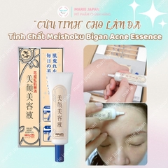 Serum Giảm Mụn Meishoku Bigan Xẹp Mụn Giảm Sưng Viêm Mờ Thâm Nhật Bản Acne Essence Túyp 15g - TẶNG 1 SRM GIẢM MỤN MEISHOKU 15G