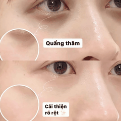 Kem Mắt Biyougeneki Eye Cream Dưỡng Sáng Giảm Thâm  Quầng Mắt Làm Mờ Nếp Nhăn Nhật Bản 20g