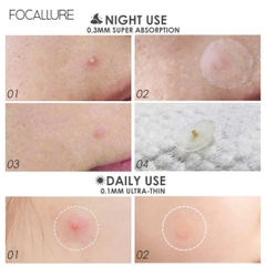 Miếng Dán Mụn Focallure Hỗ Trợ Giảm Mụn Kiểm Soát Dầu Chống Thấm Nước Acne Pimple Patch 24 Miếng