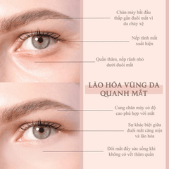 Kem Mắt Biyougeneki Eye Cream Dưỡng Sáng Giảm Thâm  Quầng Mắt Làm Mờ Nếp Nhăn Nhật Bản 20g