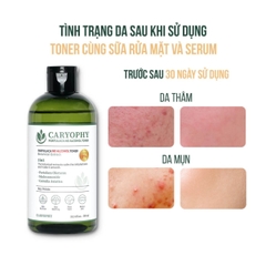 Toner Caryophy 3in1 Portulaca Cấp Ẩm Giảm Mụn Không Cồn Dịu Nhẹ Hàn Quốc 300ml