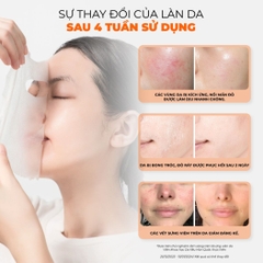 Mặt Nạ BNBG Placenta Skin Booster Mask Cấp Ẩm Dưỡng Trắng Phục Hồi Trẻ Hóa Da Hàn Quốc Hộp 10 Miếng