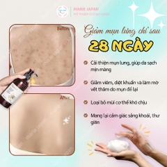 Gel Tắm Bí Đao Cocoon Giúp Giảm Mụn Lưng Winter Melon Shower Chai 310ml