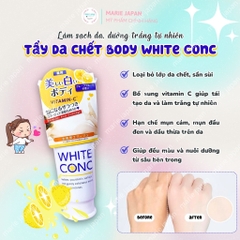 Tẩy TBC White Conc Nhật Bản Tuýp 180g