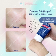 SRM Compliment No Problem - ĐỎ SALICYLIC ACID 200ml