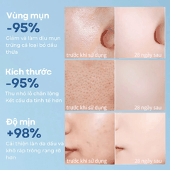 Nước Tẩy Trang Compliment Micellar Water - XANH LÁ THUẦN CHAY -Chai 400ml