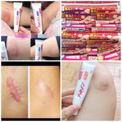 Kem Mờ Sẹo Kobayashi - XANH GEL Tuýp 15g