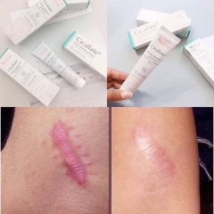 Kem Dưỡng Avene Cicalfate Repair Cream - TUÝP NHỎ 40ml