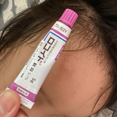 Kem Rokoito Locoid Ointment Bôi Vết Đốt Côn Trùng Muỗi Đốt 5g Nhật Bản