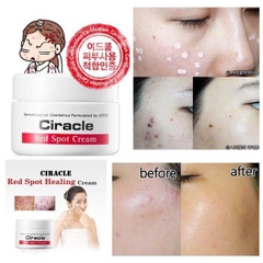 Kem Giảm Mụn Sưng Đỏ Mụn Mủ Ciracle Red Spot Cream 30ml