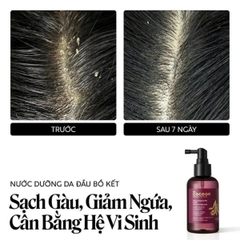 Nước Dưỡng Tóc Bồ Kết Cocoon Gleditsia Scalp Tonic Giảm Gàu Giảm Gãy Rụng Tóc Bóng Khỏe 140ml