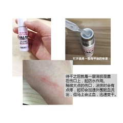 Gel Bôi Lành Vết Thương Kobayashi 10g