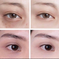 Kem Dưỡng Mắt Dạng Lăn Giảm Thâm Simple Revitalising Eye Roll-On 15ml