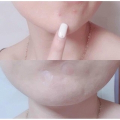 Miếng Dán Mụn Cosrx Acne Pimple Master Patch