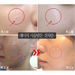 Kem Dưỡng Medi Peel Centella Rau Má Tuýp 30ml