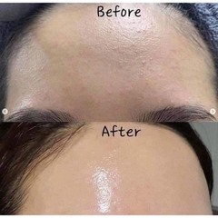 Serum SVR Sebiaclear 14% GLUCONOLACTONE + 4% NIACINAMIDE Chai 30ml