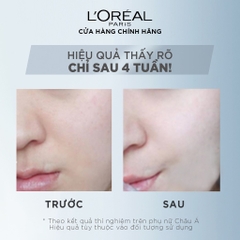 Kem Dưỡng Trắng Da Loreal White Perfect Cream Ngày & Đêm SPF17 PA++ 50ml