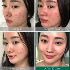 Serum Some By Mi AHA BHA PHA 30 Days Miracle Chai 50ml
