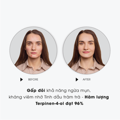 Toner Tràm Trà Milaganics Giảm Sưng Viêm Ngăn Mụn Cấp Ẩm Chai 250ml