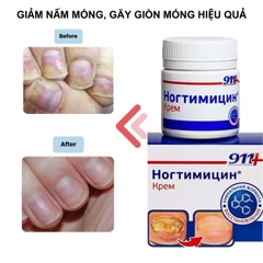 Kem Bôi Giảm Nấm Móng KPEM 911 Diệt Khuẩn Phục Hồi Giúp Móng Chắc Khỏe 30ML Nga