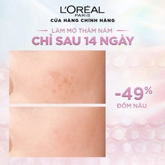 Sữa Rửa Mặt L'Oreal Paris Revitalift Hyaluronic Acid /Glycolic-Bright Glowing Daily Cleanser Foam Làm Sạch Sâu Cấp Ẩm Sáng Da Pháp - Tuýp 100ml