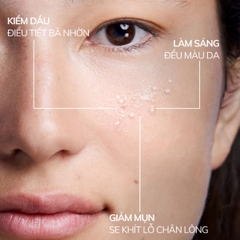Serum Compliment No Problem AHA BHA PHA Giảm Mụn Mờ Thâm Da Dầu Mụn 27ml